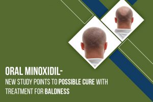 Treatment For Baldness