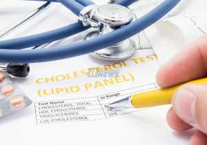 How to Calculate Your Cholesterol Ratio